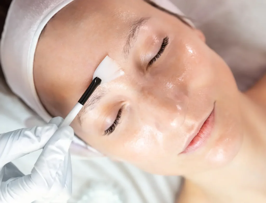 Skin Tech Chemical Peels Course UK